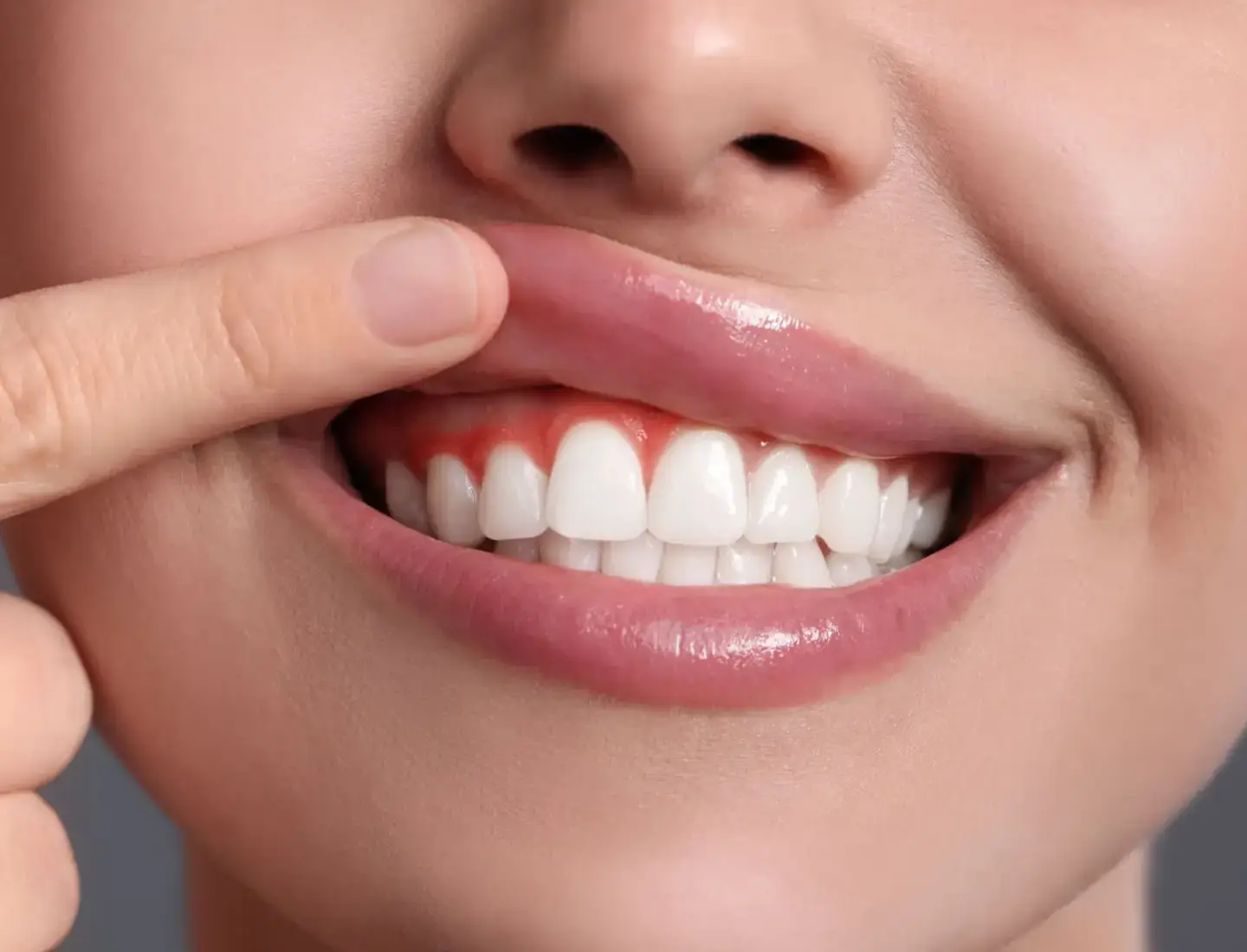 Gum Treatments in Torquay