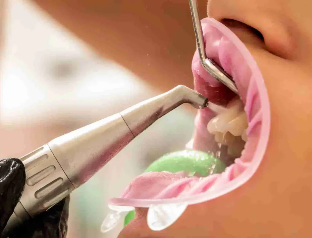oral hygiene in torquay