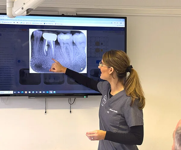 Root Canal Treatments in Torquay